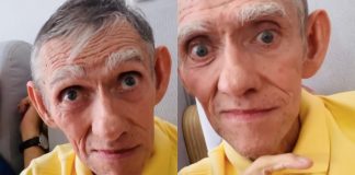 Murió «el feo más querido y famoso de Colombia»