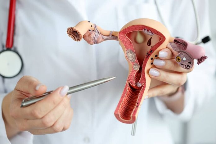 cancer cuello uterino