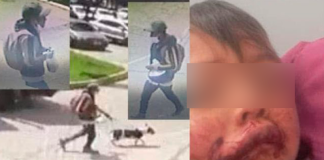 Ataque de perro a menor de edad en Tunja: esto dice la Policía Metun